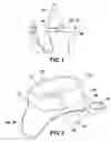 Fig. 02 - Traction adjustable cervical collar for transferring weight of the head of a wearer from the cervical spine of the wearer to the shoulders of the wearer