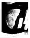 Fig. 08 - Wound dressing