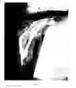 Fig. 09 - Wound dressing