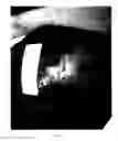 Fig. 10 - Wound dressing