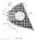 Fig. 06 - Device for radiation treatment of proliferative tissue surrounding a cavity in an animal body