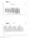 Fig. 06 - Music detection with low-complexity pitch correlation algorithm