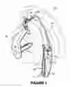 Fig. 02 - Lift tool