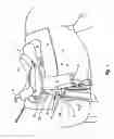 Fig. 02 - Saddle fender bender