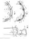 Fig. 03 - Saddle fender bender