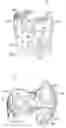 Fig. 07 - Impact excavation system and method with suspension flow control