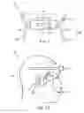 Fig. 02 - Bone conduction systems and methods