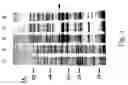 Fig. 08 - Hyaluronan synthase gene and uses thereof