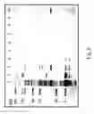 Fig. 09 - Hyaluronan synthase gene and uses thereof