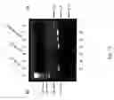 Fig. 16 - Hyaluronan synthase gene and uses thereof