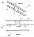 Fig. 09 - Methods and system for tissue cavity closure