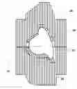 Fig. 01 - Verifying lesion characteristics using beam shapes