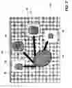 Fig. 08 - Verifying lesion characteristics using beam shapes