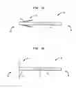 Fig. 02 - Urethral radiation treatment system and method