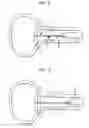 Fig. 06 - Urethral radiation treatment system and method