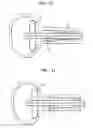 Fig. 08 - Urethral radiation treatment system and method