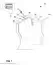 Fig. 02 - Cerebral spinal fluid flow sensing device
