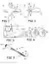 Fig. 02 - Methods and devices for occlusion of an atrial appendage