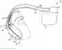 Fig. 01 - High frequency atrial burst pacing for improved ventricular rate control during atrial arrhythmias