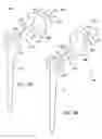 Fig. 06 - Shoulder implant assembly