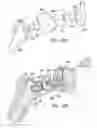 Fig. 14 - Shoulder implant assembly