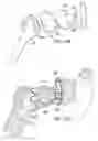 Fig. 18 - Shoulder implant assembly