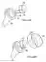 Fig. 20 - Shoulder implant assembly