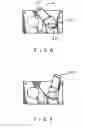 Fig. 09 - Gas valve switch structure of gas stove
