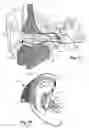Fig. 06 - Transducer for electromagnetic hearing devices