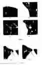 Fig. 07 - GGN segmentation in pulmonary images for accuracy and consistency