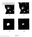 Fig. 08 - GGN segmentation in pulmonary images for accuracy and consistency