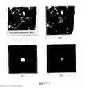 Fig. 09 - GGN segmentation in pulmonary images for accuracy and consistency