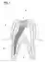Fig. 02 - Tooth root canal point