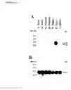 Fig. 06 - Human brain carboxypeptidase B antibodies