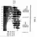 Fig. 15 - Vascular endothelial growth factor 2