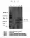 Fig. 16 - Vascular endothelial growth factor 2