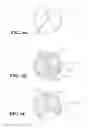 Fig. 06 - Coaxial catheter systems for transference of medium