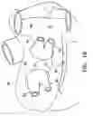 Fig. 07 - Ablation probe with stabilizing member