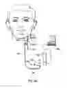 Fig. 02 - Impedance measurement for an implantable device
