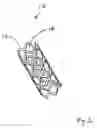 Fig. 02 - Bioabsorbable self-expanding endolumenal devices