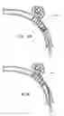 Fig. 19 - Bioabsorbable self-expanding endolumenal devices