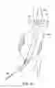 Fig. 05 - Methods and systems for endovascular aneurysm treatment