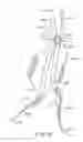 Fig. 12 - Methods and systems for endovascular aneurysm treatment