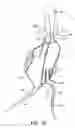 Fig. 14 - Methods and systems for endovascular aneurysm treatment