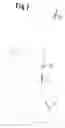 Fig. 06 - Breast prosthesis
