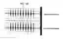 Fig. 06 - Apparatus and method of eliminating noise from a recording device