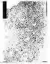Fig. 01 - Powder of fine alloy particles having an uneven surface and method of manufacturing the powder