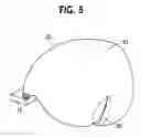 Fig. 06 - Airbag device