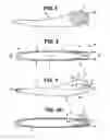 Fig. 02 - Tweezer, kit, method, and package