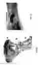 Fig. 07 - Treatment of wounds and compositions employed